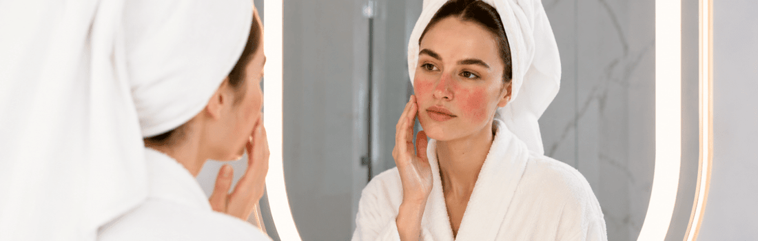 How to Reduce Red Skin on Your Face - SkincareEssentials